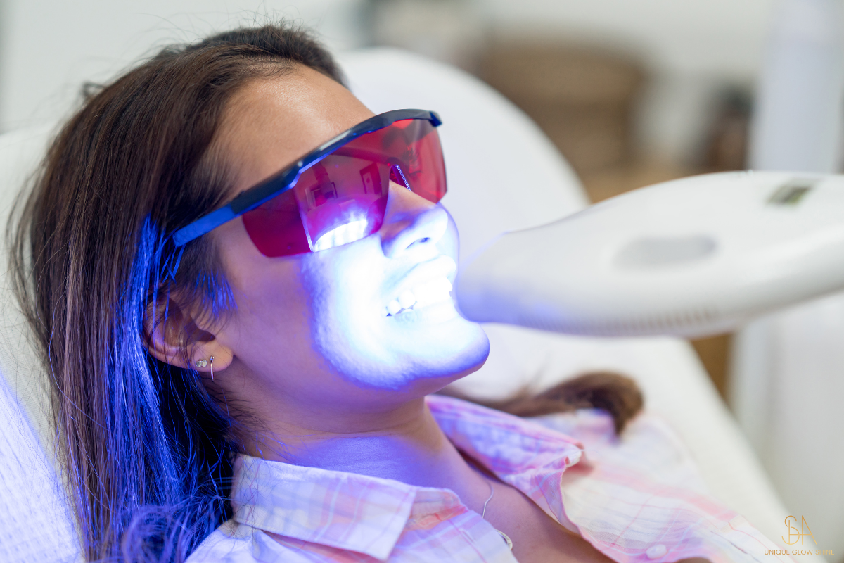 Zahnbleaching-Leistung