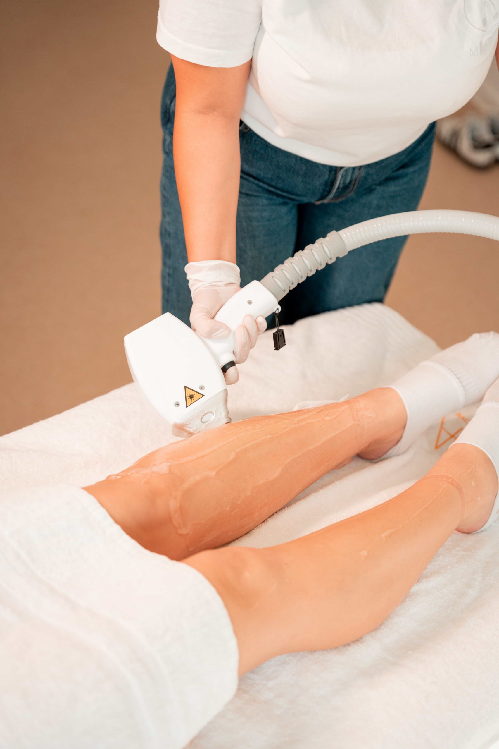 beine werden mit dem Laser behandelt. Dauerhafte Haarentfernung in Obertshausen