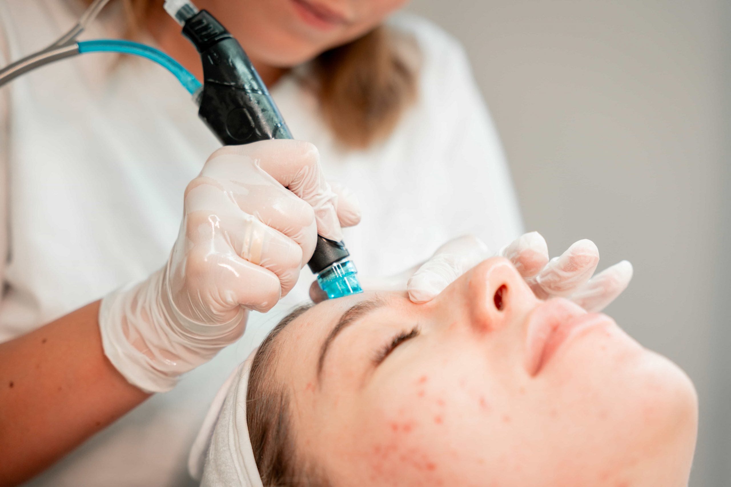 Gesichtsbehandlung in Obertshausen