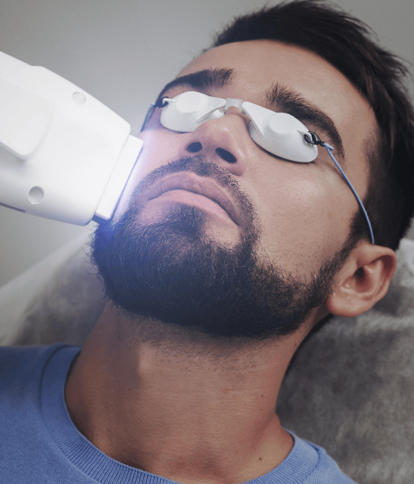 Bartkontur Laser Behandlungen in Obertshausen