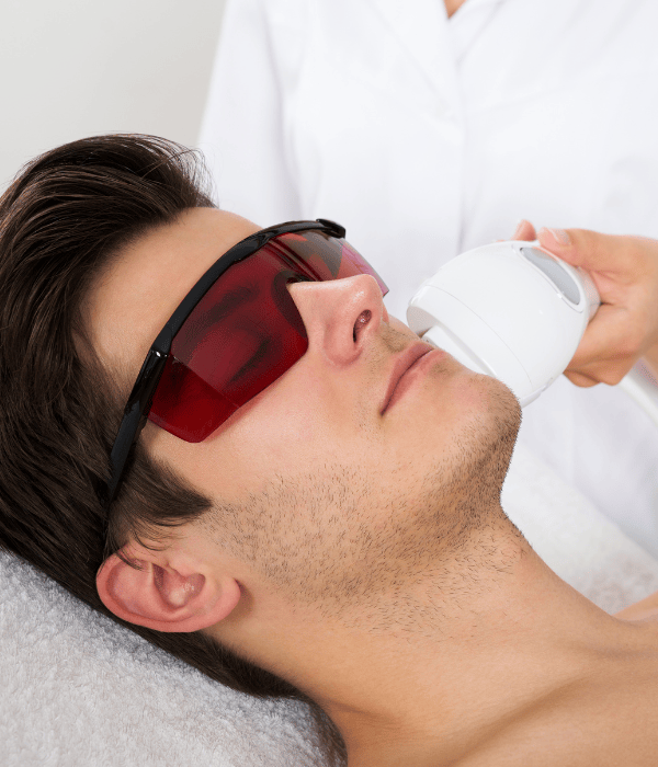 Bartkontur Laser Behandlungen in Obertshausen